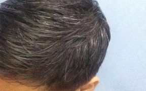 অকালে চুল পাকা রোধে পেঁয়াজ-বাদাম-ছোলা -abcb news